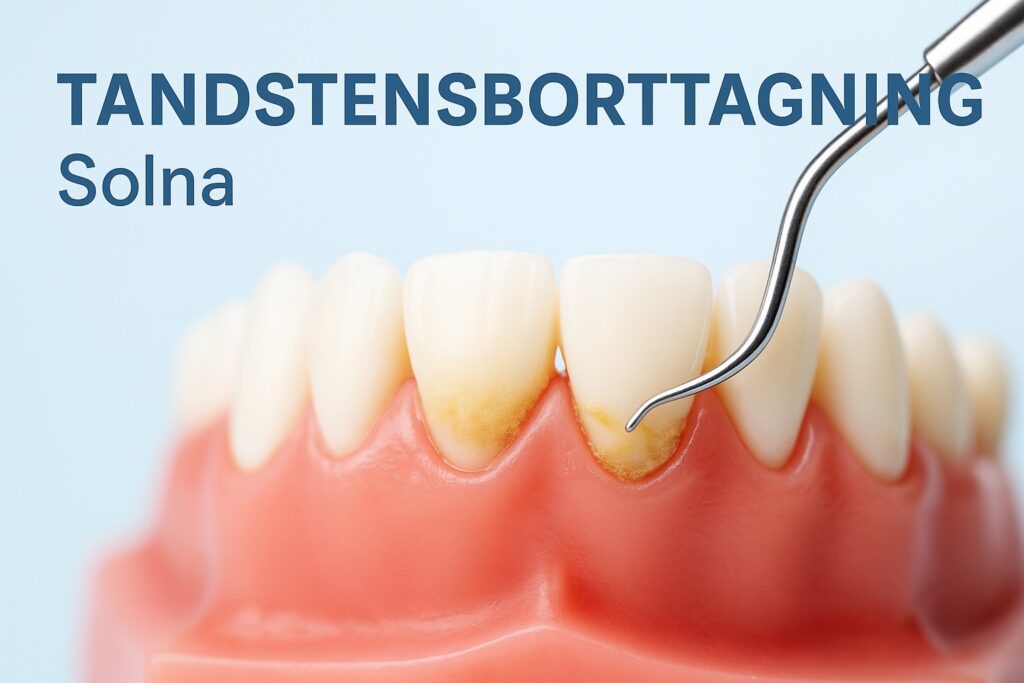Tandstensborttagning i Solna – professionell borttagning av tandsten